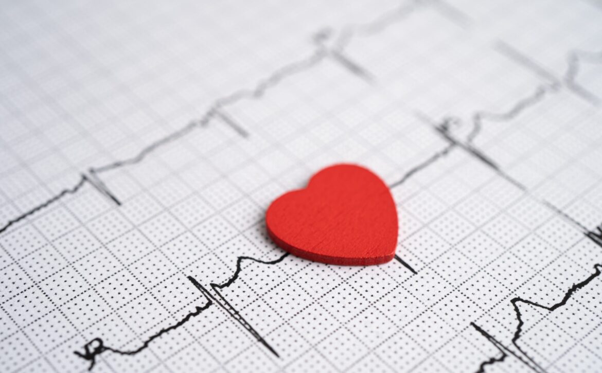 Electrocardiogram,,Ecg,With,Red,Heart,,Heart,Wave,,Heart,Attack,,Cardiogram